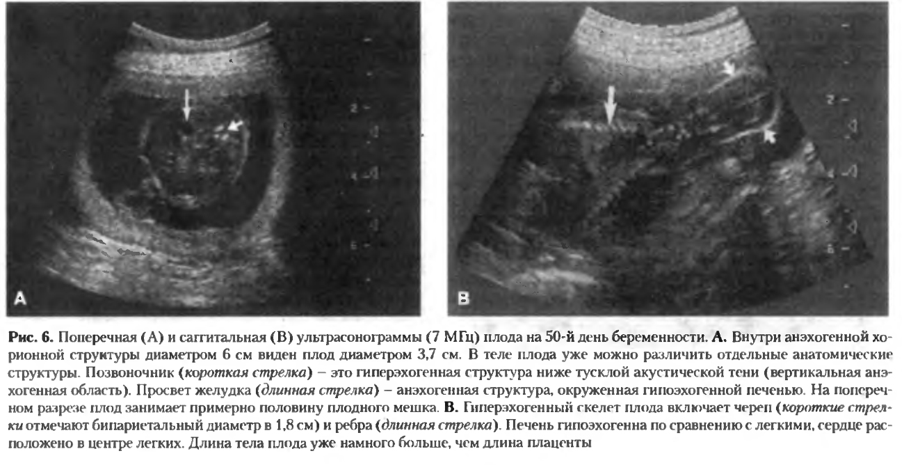 Узи собак сроки. Узи собак сроки. 25 дней беременности собаки. Узи по беременности у собаки. Определение срока беременности по узи.