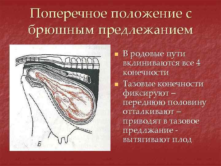 Поперечное положение